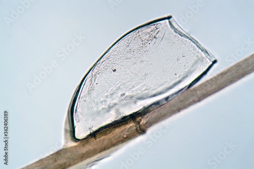 Egg or nit of a head louse, Pediculus humanus, on a human hair