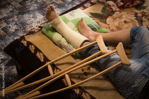 Gypsum is imposed on the man’s leg and walking on crutches is prescribed, and bed rest, as he has a closed fracture of the fibula without displacement.