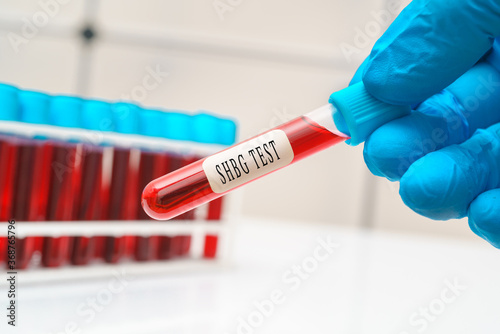 Blood sample test tube in doctor hand for binding globulin / SHBG test.