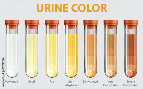 Illustration of urine color chart