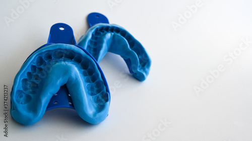 Close up of a dentist dental technique bite 3D impression teeth - molding trays - upper and lower jaw.