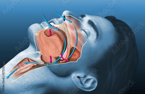 Snoring man, medically 3D illustration