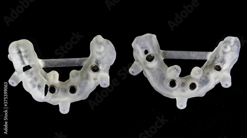 two surgical dental guides for large implantation of the upper and lower jaws, top view on a black background