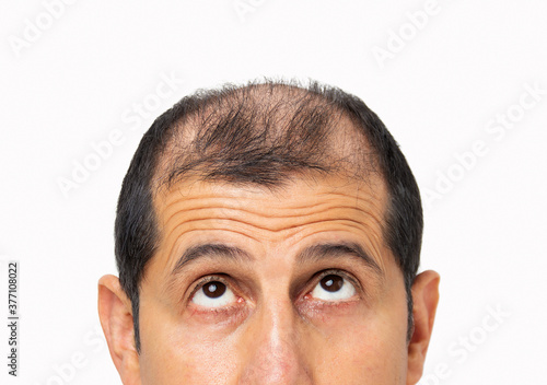 Young bald man over white isolated background looking up sad, upset, unhappy and depressed.