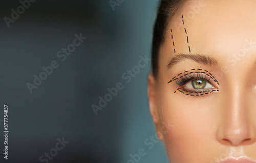 Lower and upper Blepharoplasty.Marking the face.Perforation lines on females face, plastic surgery concept.