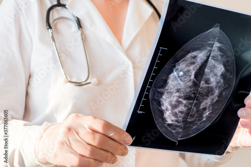 Female doctor looking at mammography results on x-ray