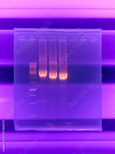 result of agarose gel electrophoresis of PCR products. separation of DNA fragments amplified with the PCR is used for genotyping of transgenic lines in search for heterozygeous lines with tDNA insert