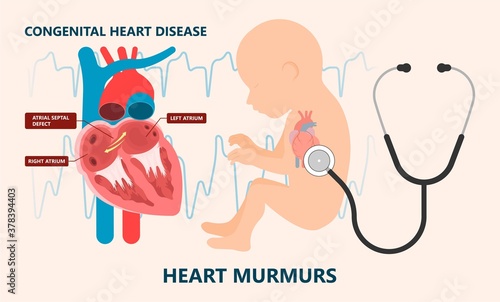 Cath Lab Atrial Septal Defect Tetralogy of Fallot Patent Foramen Ovale Mitral Valve Stenosis Heart Attack Ductus Arteriosus Doppler Coronary Artery Disease Congestive Congenital Valvular VSD exam leak