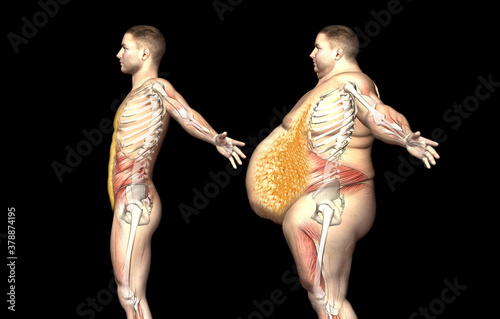 representación 3D. La grasa se acumula en el abdomen, tanto superficialmente como internamente. La grasa que se adhiere a la zona interna se denomina grasa visceral y rodea los órganos 