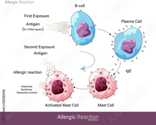 Mechanism of Human allergic reaction caused by a foreign substance or Allergens like pollen grain which are harmless but lead to hypersensitivity and activation of Mast cell degranulation vector eps