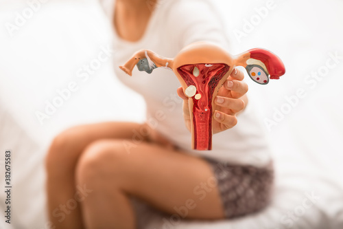 unrecognizing woman with abdominal pain holds the anatomical model of uterus and ovaries with pathology. diseases uterus and ovaries, endometriosis, ovarian cysts