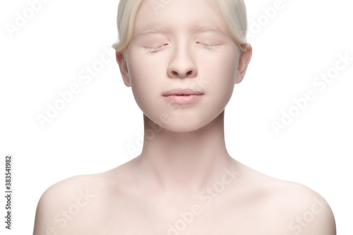 Innocent. Portrait of beautiful albino woman isolated on white studio background. Beauty, fashion, skincare, cosmetics concept. Copyspace. Well-kept skin, fresh look. Inclusion and diversity.