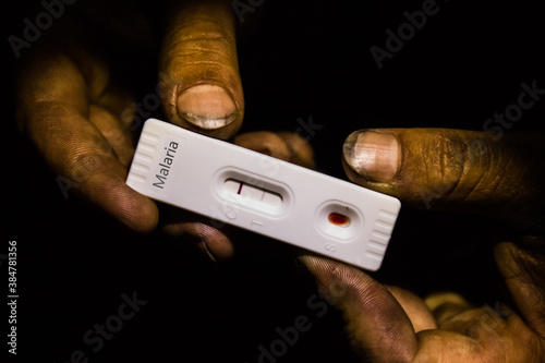 Dirty hands holding a positive malaria test in the dark