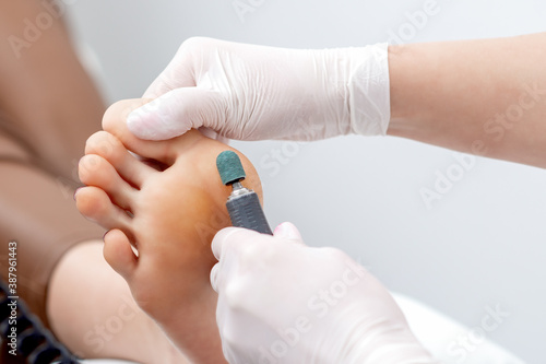Peeling feet pedicure procedure from callus on foot by hands of podiatrist in white gloves at beauty salon