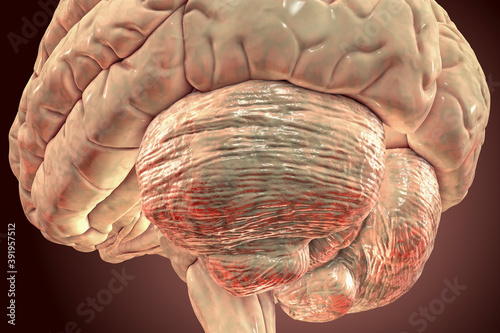 Human brain with highlighted cerebellum