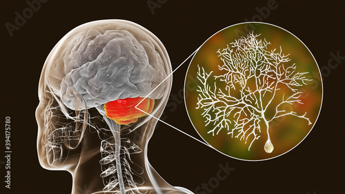 Human brain with highlighted cerebellum and close-up view of Purkinje neurons