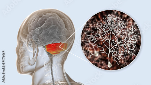 Human brain with highlighted cerebellum and close-up view of Purkinje neurons