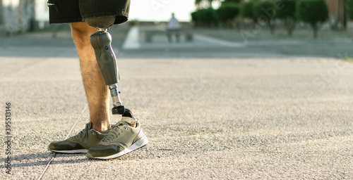 Low angle view at disabled young man with prosthetic leg walking along the street