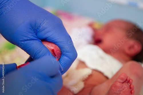 Newborn blood spot or heel prick test (the Guthrie test). A paediatrician making a pinprick puncture in one heel of the newborn to collect their blood in order to screen for inborn metabolic diseases.