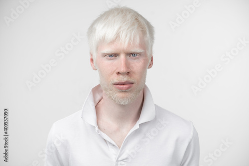 portrait of an albino man in studio dressed t-shirt isolated on a white background. abnormal deviations. unusual appearance