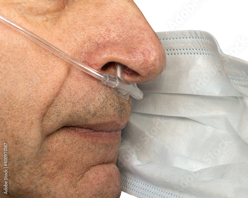 Profile of a man with a medical mask and nasal cannula