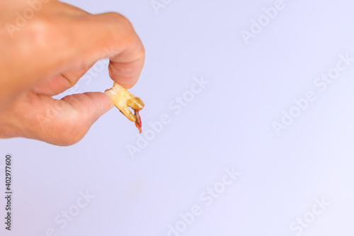 Extraction of an inflamed tooth with an abscess in the tooth. White background