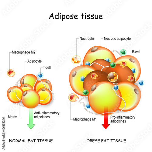 Adipocytes, obesity, and inflammation. normal, and obese adipose tissue.