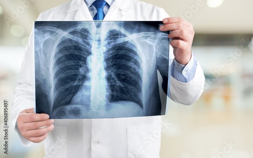 Young man doctor holding x-ray