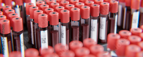 EDTA Serum Blutproben Röhrchen in Labor