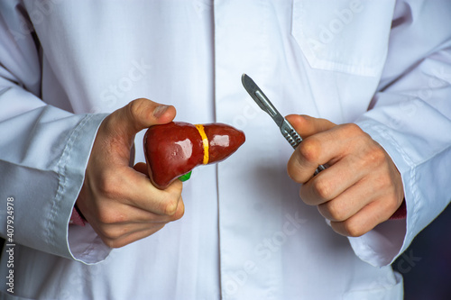 Concept photo of surgery on the liver and gallbladder (hepatobiliary area). Surgeon holds a scalpel in one hand and a figurine of a liver with a gallbladder in other, simulating a surgical operation