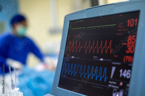 EKG monitor in intra aortic balloon pump machine. Medical equipment.