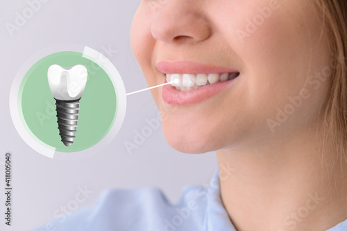 Young woman with implanted teeth on light background, closeup