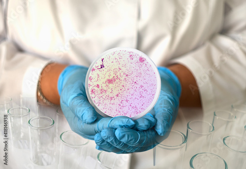 a girl in a medical gown and gloves holds a photo gonorrhea from a microscope in a round frame