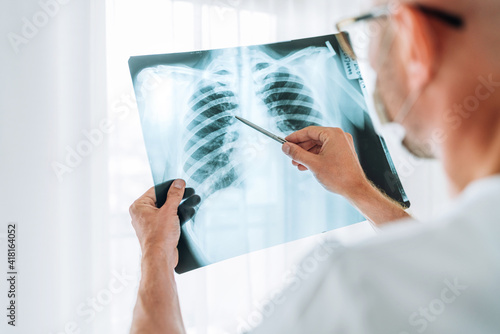 Male doctor examining the patient chest x-ray film lungs scan at radiology department in hospital.Covid-19 scan body xray test detection for covid worldwide virus epidemic spread concept.