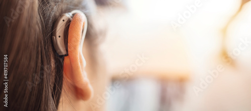 Deaf woman wearing hearing aid. Digital hearing aid in woman's ear. Brunette Woman with Modern Hearing Aid. Hearing Impaired.