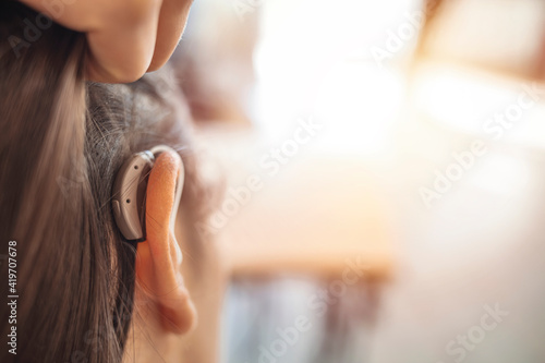 Modern digital in the ear hearing aid for deafness and the hard of hearing patients. Young woman with hearing aid indoors. Young woman with hearing aid on light background. Copy space