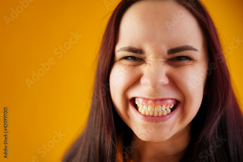 Portrait of young woman with grimacing face. Close up of funny female showing overbite on yellow background.