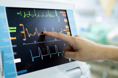 EKG monitor in intra aortic balloon pump machine. Medical equipment in hospital. Medical Technology 