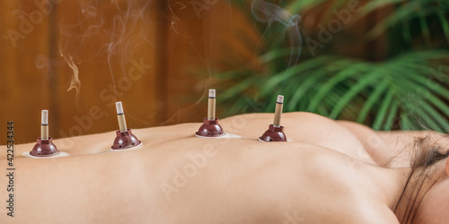 Mugwort moxibustion Back Therapy