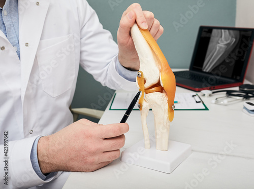 Human cruciate ligament injury treatment concept. Orthopedist showing to cruciate ligament in a knee-joint medical teaching model, close-up