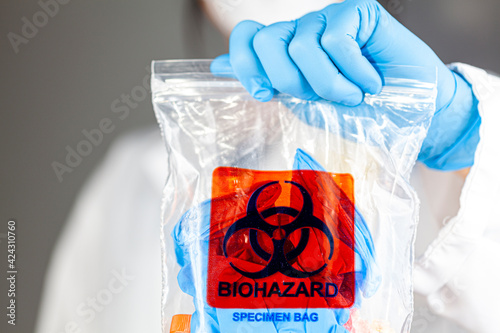 A woman researcher is holding a clear plastic bag with biohazard logo printed on. The bag contains, potentially dangerous biological specimens. Scientists discard these waste in these labelled bags.