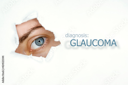 Woman`s eye looking trough teared hole in paper, word Glaucoma on left. Eye disease concept template. Isolated white background.