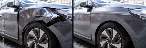 Photo Of Car Dent Repair Before