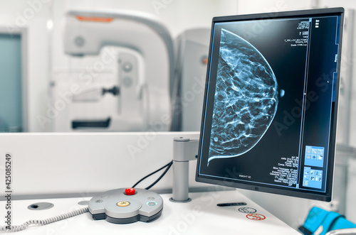 Mammogram snapshot of breasts of a female patient on the monitor with undergoing mammography test on the background. Mammography test at the hospital. Medical equipment.