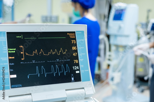 EKG monitor in intra aortic balloon pump machine. Medical equipment.