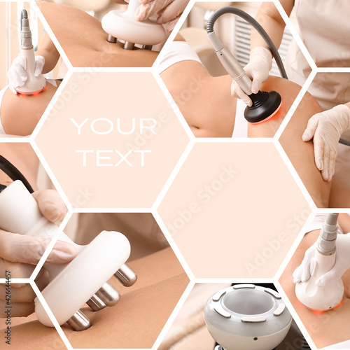 Collage of young woman undergoing procedure of anti-cellulite massage in beauty salon, space for text