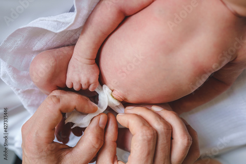 Hands of unknown man father caring for umbilical cord with clamp and bandage of newborn baby neonatal care parent clean navel of baby on bed at home