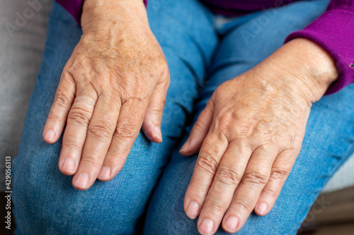 Elderly woman applying moisturizing lotion cream on hand palm, easing aches. Senior old lady experiencing severe arthritis rheumatics pains, massaging, warming up arm. Close up, copy space, background