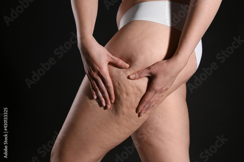 Woman with cellulite on black background, closeup