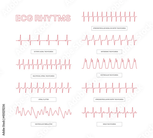 Ecg templates. Medical infographic lines heart arrhythmia health conceptual pictures for doctors info garish vector ecg illustrations